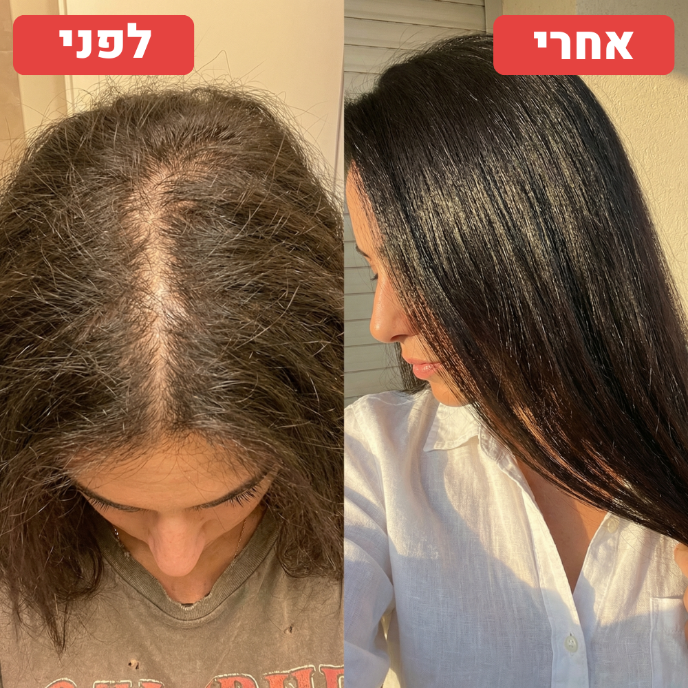 תמונת לפני ואחרי שנמסרה ל־RIVERA