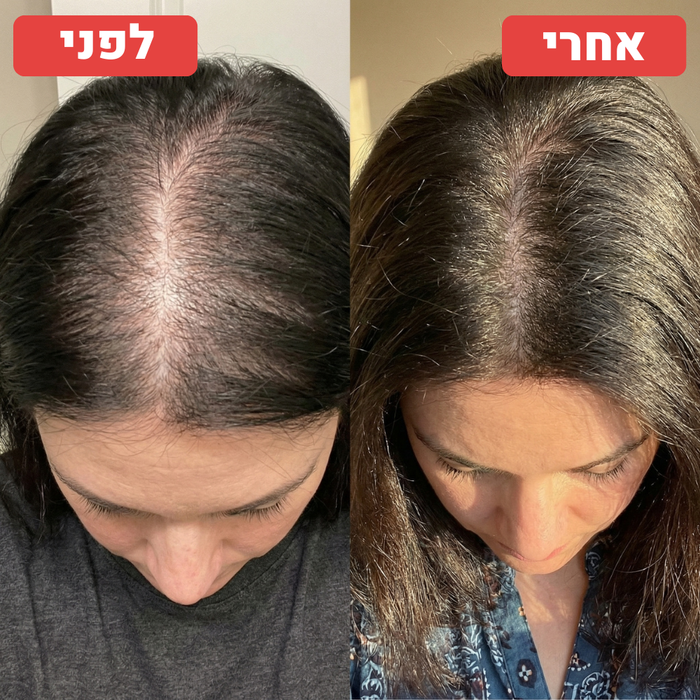 תמונת לפני ואחרי שנמסרה ל־RIVERA