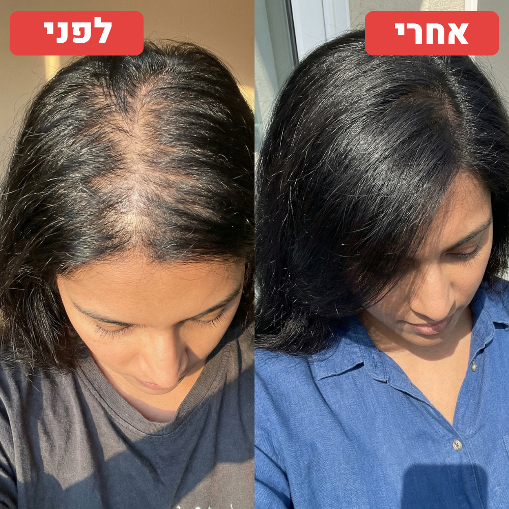 תמונת לפני ואחרי שנמסרה ל־RIVERA